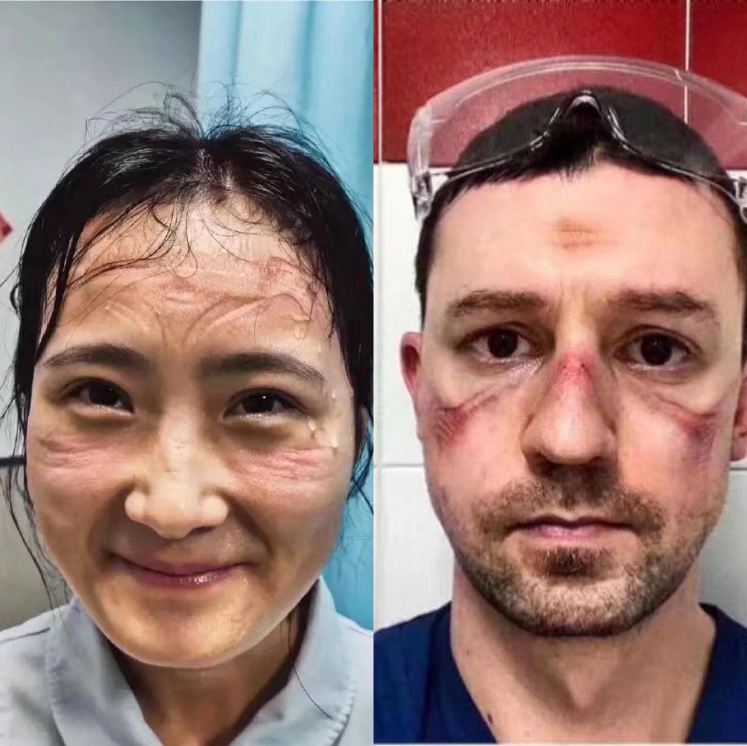 全球疫情现状及其影响，疫情究竟在哪里？